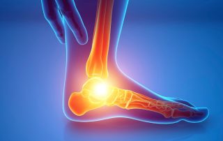 SoftRay™ Therapy for Arthritis, Heel & Joint Pain Relief
